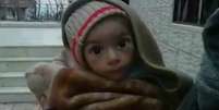 Ativistas divulgaram imagens de crianças desnutridas, confirmadas pela agência Reuters  Foto: BBC / BBC News Brasil