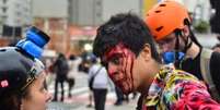 Jovem ficou ferido durante protesto contra aumento das passagens de transporte coletivo na terça-feira  Foto: Agência Brasil