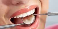 Os dentes do siso costumam surgir no início da fase adulta.  Foto: iStock/Getty Images / Vivo Mais Saudável