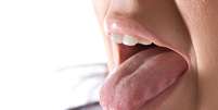 A saburra lingual é uma camada esbranquiçada ou amarelada que fica sobre a nossa língua, bem lá no fundo perto da garganta  Foto: ARENA Creative / Shutterstock