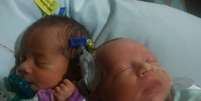 As irm&atilde;s g&ecirc;meas Darla (esq.) e Dalanie nasceram em 17 de junho  Foto: Danesha Cough