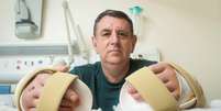 Chris King é a primeira pessoa do Reino Unido a sofrer um duplo transplante de mãos  Foto: EFE