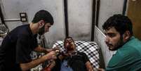 Jovem sírio recebe atendimento médico após bombardeio  Foto: EFE
