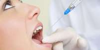 Estudos mostram que quase 80% da popula&ccedil;&atilde;o sofre com alguma ansiedade quando visitam o dentista e as anestesias t&ecirc;m uma grande parcela de culpa nisso  Foto: Diego Cervo / Shutterstock