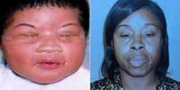 Kamiyah Mobley quando bebê e a mulher presa por seu sequestro, Gloria Williams  Foto: BBC News Brasil