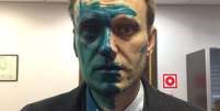 O opositor Navalny já foi atacado com o líquido duas vezes  Foto: @navalny / BBC News Brasil