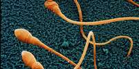 Espermatozoides vistos no microscópio eletrônico  Foto: BBC News Brasil