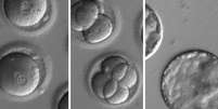 Fotos de embriões geneticamente modificados: cientistas conseguiram editar genes que causavam a cardiomiopatia hipertrófica a ser transmitida de pais para filhos   Foto: BBCBrasil.com
