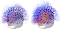 Imagens da atividade cerebral do paciente  Foto: BBC News Brasil