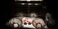 Bebê prematuro  Foto: BBC News Brasil