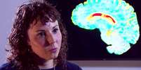 Professora Sarah Tabrizi , do Instituto de Neurologia UCL, liderou os experimentos.  Foto: BBC News Brasil