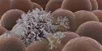 Câncer é a doença que mais amedronta brasileiros; ela surge de mutações genéticas que transformam celulas em tumorais  Foto: Getty Images / BBC News Brasil