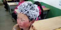 Foto do pequeno Wang, com o cabelo e as sobrancelhas cobertos de neve, viralizou na internet | Foto: People's Daily  Foto: BBC News Brasil
