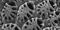 Klugerella petasus, uma espécies de briozoário descrita para o Brasil. A foto tirada no Microscópio Eletrônico de Varredura mostra a complexidade do exoesqueleto dos briozoários  Foto: BBC News Brasil