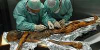 Pesquisadores vasculham múmia em busca de indícios da alimentação  Foto: South Tyrol Archaeology Museum\Eurac\M.Samadelli / BBC News Brasil