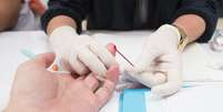 Cerca de 75% contaminadas com o HIV sabem do diagnóstico  Foto: Getty Images / BBC News Brasil