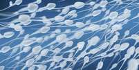 Crendices dos anos 1600 especulavam que 'cada espermatozoide continha um pequeno humano adulto pr&eacute;-formado, enrolado em seu interior'  Foto: iStock/Getty Images / BBC News Brasil