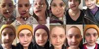 Jen Taylor, de 30 anos, diz que tirar uma foto todos os dias do próprio rosto ajudou a enfrentar as mudanças depois da cirurgia de reconstrução facial  Foto: Jen Taylor / BBC News Brasil