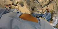 Robô usado em cirurgia de remoção de tumor no colo do útero  Foto: DIVULGAÇÃO / Estadão Conteúdo