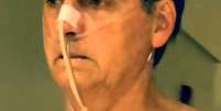 Jair Bolsonaro aparece caminhando no corredor do hospital com sonda no nariz em novo vídeo publicado pelo filho, o vereador Carlos Bolsonaro  Foto: Reprodução / Estadão Conteúdo