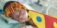 Hospital fantasia bebês da UTI Neonatal para o carnaval  Foto: Getty Images / Minha Vida
