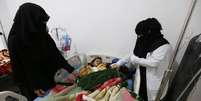 Uma criança internada com sarampo no Iêmen; dez países foram responsáveis por 74% do aumento do número de casos no mundo entre 2017 e 2018  Foto: YAHYA ARHAB/EPA / BBC News Brasil