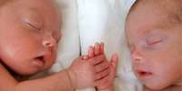 Especialistas explicam que o raro fenômeno "feto in fetus" acontece quando o óvulo fecundado se divide depois da segunda semana e não na primeira, como acontece no caso de gêmeos idênticos  Foto: Getty Images / BBC News Brasil