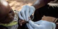 OMS lança 1º teste em grande escala de vacina contra malária  Foto: ANSA / Ansa