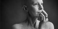 Liz O'Riordan foi diagnosticada com câncer de mama pela primeira vez em 2015  Foto: Alex Kilbee / BBC News Brasil