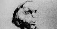 Joseph Merrick surpreendeu médicos com sua natureza inteligente e sensível  Foto: PA / BBC News Brasil