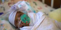 Saybie, que nasceu com 245 gramas, recebeu alta do hospital ap&oacute;s cinco meses de cuidados intensivos  Foto: AFP / BBC News Brasil