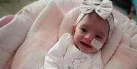 Ivy Worsley &eacute; hoje uma menina saud&aacute;vel de nove meses  Foto: Laura Worsley / BBC News Brasil