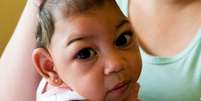 Entre 2015 e 2016, cerca de 3 mil crianças nasceram com microcefalia, a maioria delas na empobrecida região Nordeste  Foto: DW / Deutsche Welle