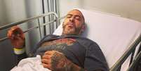 Henrique Fogaça em maca de hospital após acidente de moto.  Foto: Instagram / @henrique_fogaca74 / Estadão