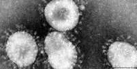 Coronavírus podem causar infecções que vão desde resfriados comuns até Sars e Mers  Foto: DW / Deutsche Welle