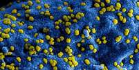 Para se replicar, coronavírus precisa 'sequestrar' célula  Foto: Getty Images / BBC News Brasil