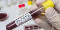 Kits permitirão que o resultado dos testes de coronavírus fique pronto em 15 minutos  Foto: Seleções