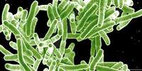 Bactéria da tuberculose vista em microscópio  Foto: DW / Deutsche Welle