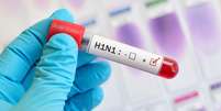 A pandemia de H1N1 afetou mais de 200 países entre 2009 e 2010  Foto: Getty Images / BBC News Brasil