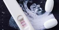 Vários Estados afirmam que abortos são procedimentos não essenciais, e ativistas dizem que restrições violam direito constitucional  Foto: Getty Images / BBC News Brasil
