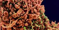 Ilustração do Instituto Nacional de Alergias e Doenças Infecciosas dos EUA mostra contágio de células pelo novo coronavírus  Foto: EPA / Ansa - Brasil