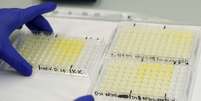 Amostras de exames para coronavírus em laboratório em Berna, na Suíça
22/04/2020 REUTERS/Arnd Wiegmann  Foto: Reuters