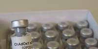 Candidata a vacina contra Covid-19 em Oxford
02/04/2020 Sean Elias/Divulgação via REUTERS   Foto: Reuters