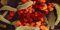 Imagem de microscópio mostra o vírus (em laranja) sobre células cultivadas em laboratório   Foto: DW / Deutsche Welle