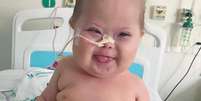 Foto de um bebê com síndrome de down em um hospital  Foto: Reprodução/Instagram / Alto Astral