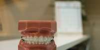 Aparelho dental na infância evita harmonização facial no futuro  Foto: Unplash