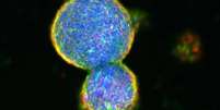 Células-tronco de embriões podem ajudar, no futuro, a medicina regenarativa  Foto: ANSA / Ansa - Brasil