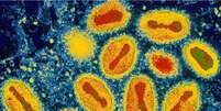 Além do Sars, apenas dois outros vírus foram levados à extinção propositalmente: varíola e peste bovina  Foto: Science Photo Library / BBC News Brasil