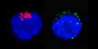 Na imagem da esquerda é possível observar a enzima RdRp do SARS-CoV-2 (em vermelho), que regula a replicação viral, no interior do linfócito T CD4.Na imagem da direita, as manchas verdes representam as proteínas de espícula do SARS-CoV-2 (spike proteins) próximas à membrana da célula de defesa humana  Foto: Unicamp/Divulgação / Estadão