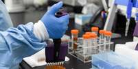 Pesquisador faz testes nos Laboratórios Biogenix, que fazem testes de detecção de Covid-19, em Masdar, Emirados Árabes
06/10/2020
REUTERS/Khushnum Bhandari  Foto: Reuters